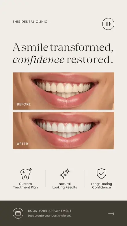 A dental-clinic web story, a before-and-after smile comparison